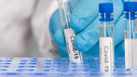 Tests de dépistage Covid-19 : l’heure de la reprise n’a pas encore sonné !