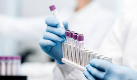 Biologie médicale : l’Académie de pharmacie dénonce la financiarisation du secteur