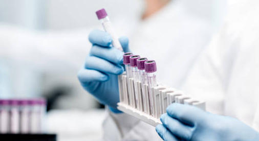 Biologie médicale : l’Académie de pharmacie dénonce la financiarisation du secteur