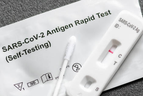 Test Covid-19 : pas d’emballement sur le dépistage