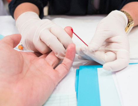 VIH et IST : le dépistage en officine passe en expérimentation