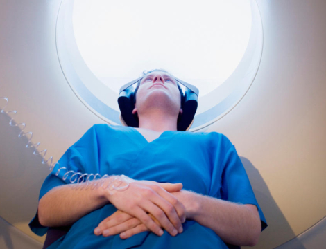 Perte du monopole des produits de contraste : les radiologues s’expliquent