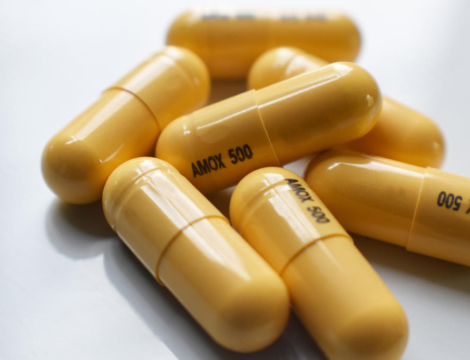 Angines à streptocoque A : par quoi remplacer l’amoxicilline ?