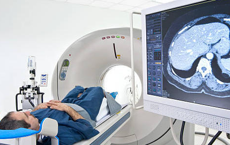 Médecins : hold-up sur la vente des produits de contraste