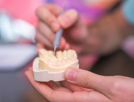 Buprénorphine : attention aux dents