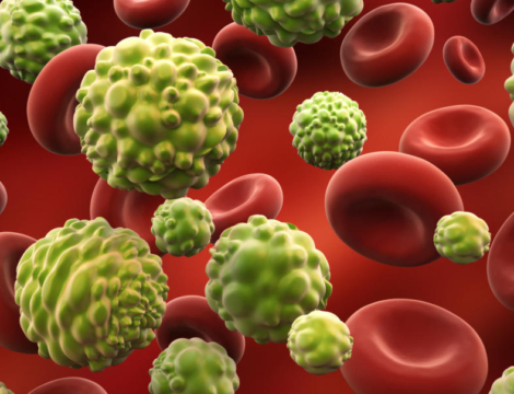 Tensions sur Tasigna 50 mg : réservé aux enfants