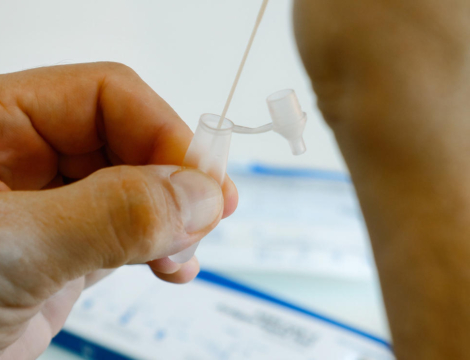 Autotests et tests combinés Covid-19/grippe : ceux qui sont autorisés