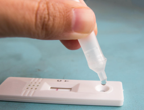 Amélioration de l&rsquo;accès aux soins : tous les Trod réalisés à l&rsquo;officine ?