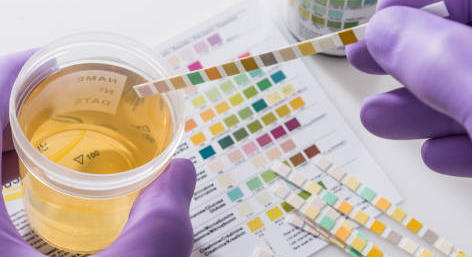 Dépistage de la cystite par bandelettes : une histoire de temps