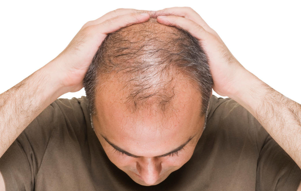 Finastéride : c’est quoi ce QR code sur la boîte ?