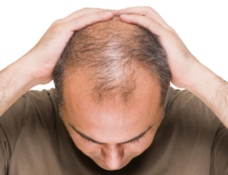 Finastéride : c’est quoi ce QR code sur la boîte ?