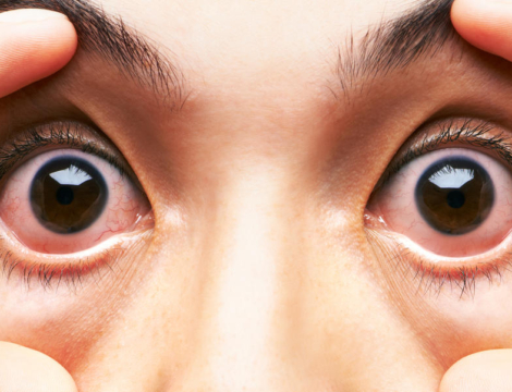 Pénuries de médicaments : relocaliser, mais pas à tout prix