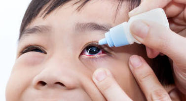 Collyre mydriatique : une surveillance plus que nécessaire chez l’enfant
