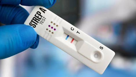 Trod angine : faire avec la réticence des médecins