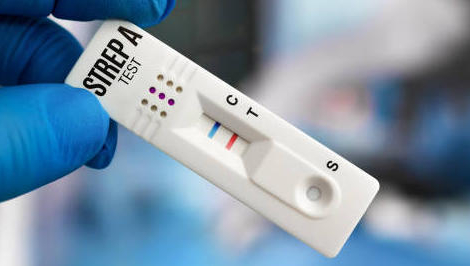 Antibiotiques : les pharmaciens pourront les prescrire pour les angines et cystites !