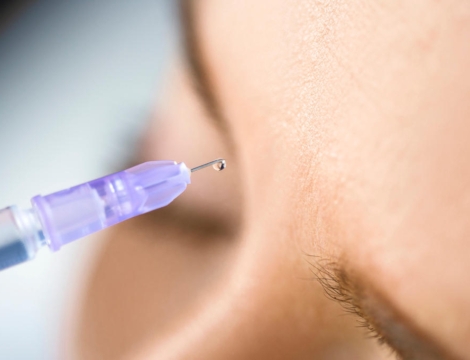 Acide hyaluronique injectable à visée esthétique : l’Ordre précise les choses