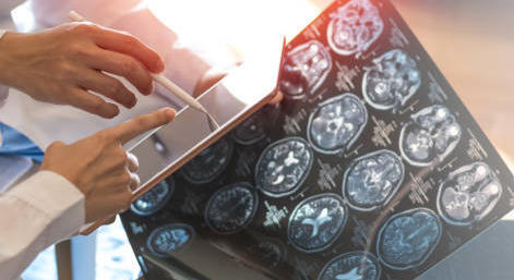 Délivrance : quelles sont les règles pour Kesimpta ?