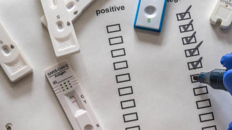 Tests antigéniques Covid-19 : comment faire désormais pour la traçabilité ?