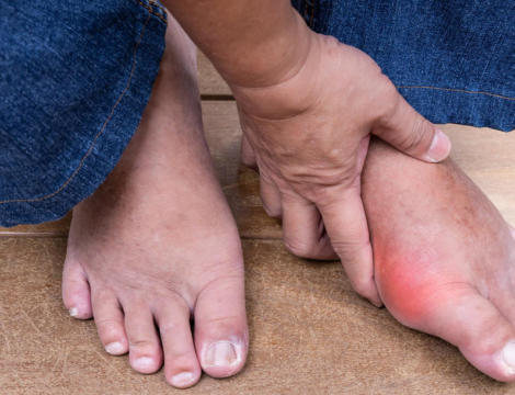 Allopurinol : pourquoi faut-il augmenter progressivement sa posologie ?