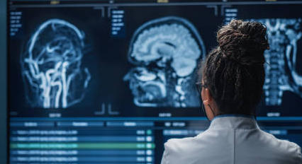 Produits de contraste : ils seront bien chez les radiologues l&rsquo;année prochaine