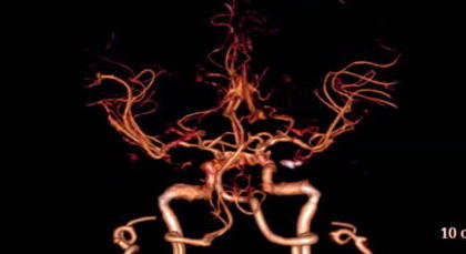 Produits de contraste : deux exceptions à la nouvelle règle