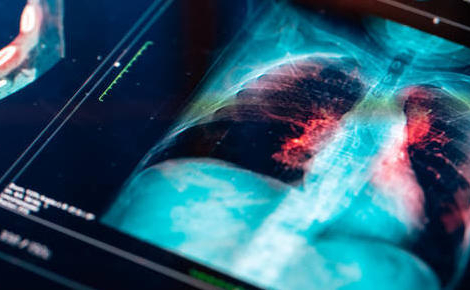 Produits de contraste : impréparation dénoncée, dérives annoncées