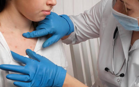 Rougeole : l’OMS alerte sur la flambée des cas