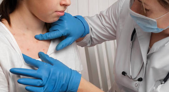 Rougeole : l’OMS alerte sur la flambée des cas