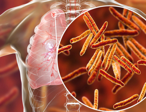 Rifater et Rifinah : fortes tensions d’approvisionnement