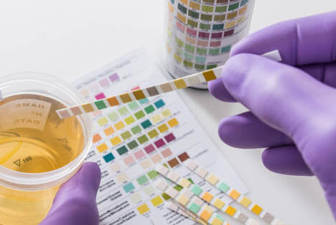 Trod cystite : les pharmaciens n’ont pas besoin d’aménager leurs locaux