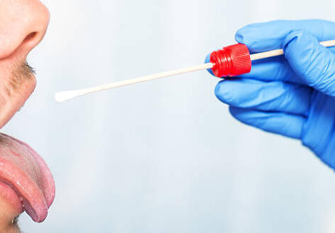 Trod angine et cystite : leur tarification fait toujours débat