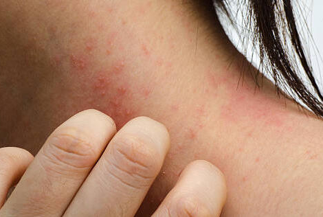 Stylos Anapen : quelles solutions pour remédier aux tensions d’approvisionnement ?