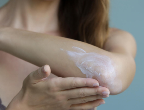 Les dermocorticoïdes peuvent-ils être à l’origine d’allergie ?