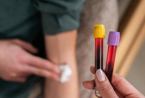 Les biologistes médicaux fermeront leurs portes du 23 au 31 décembre 2024