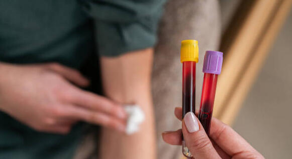 Les biologistes médicaux fermeront leurs portes du 23 au 31 décembre 2024