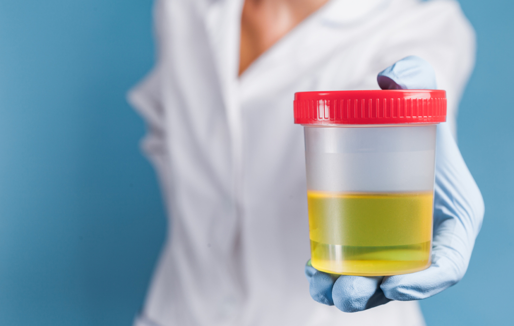 Cystite : le dépistage est officiellement autorisé à l’officine