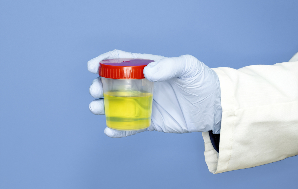 Trod cystite : le mode d’emploi pour le faire en pharmacie