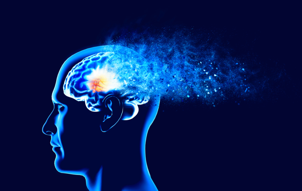 Alzheimer : quel rôle pour le pharmacien dans l’accompagnement des malades ?