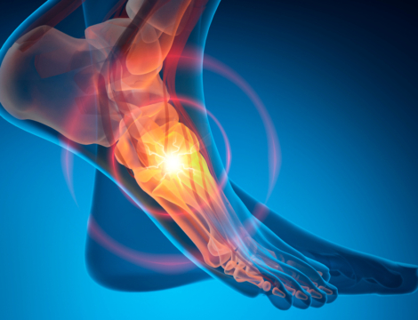 Chaussures thérapeutiques de série : conseils pour une délivrance adaptée