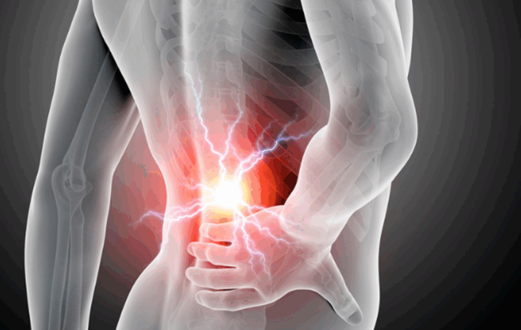 Lombalgie commune à l’officine