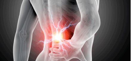 Lombalgie commune à l&rsquo;officine