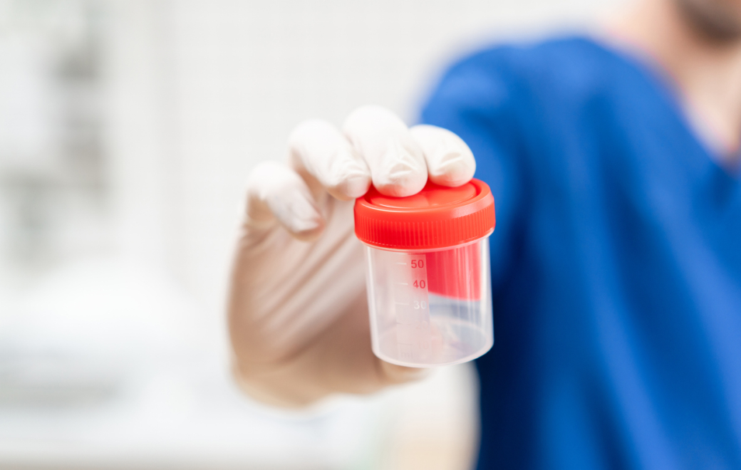 Comment réaliser un prélèvement pour ECBU chez l’adulte non sondé ?