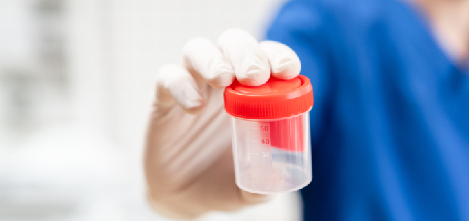 Comment réaliser un prélèvement pour ECBU chez l’adulte non sondé ?