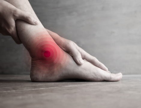 Prendre en charge une entorse de cheville à l’officine