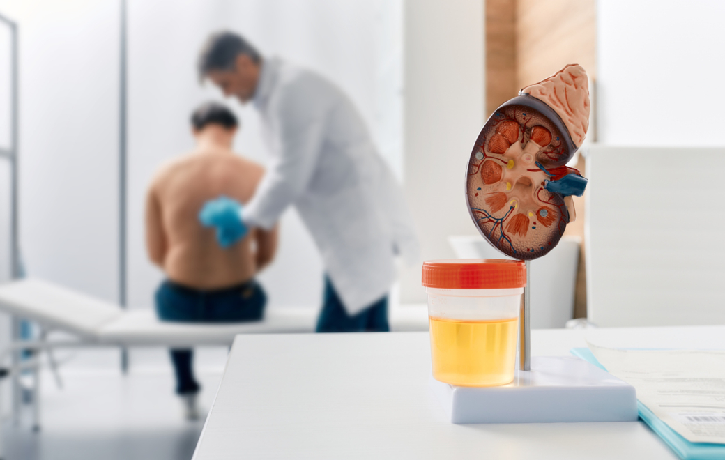 Semaine nationale du rein : une carte interactive des lieux de dépistage pour aiguiller les patients