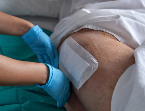Délivrance des pansements : de nouvelles règles en avril 2025