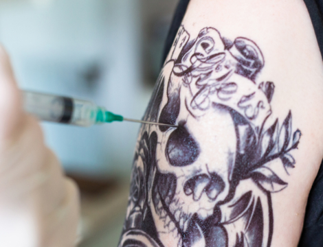 Peut-on vacciner sur un tatouage ?