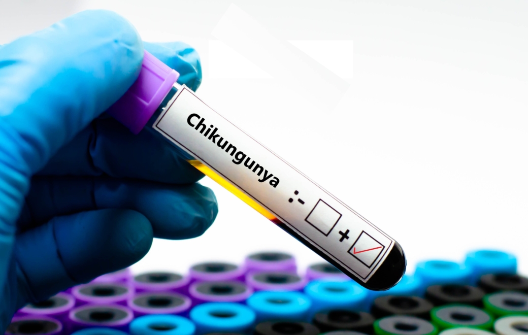 Chikungunya : un vaccin dangereux ?