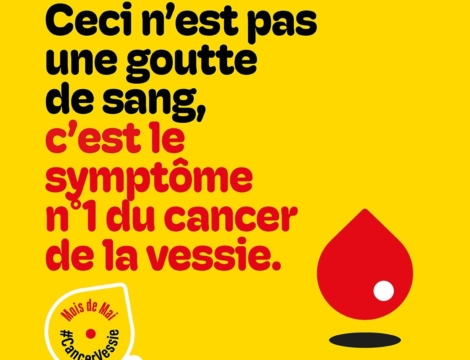 En mai, fais ce qu’il te plaît… mais checke ta vessie !