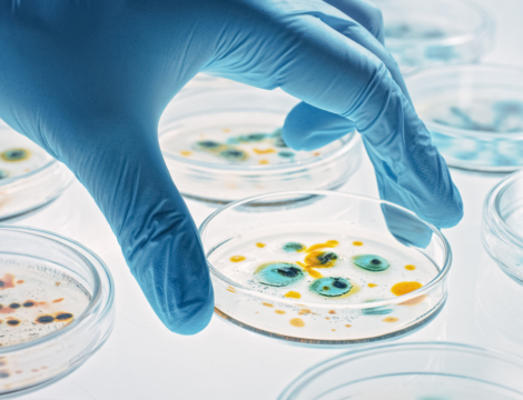 Résistance aux antimicrobiens : la France confirme son engagement